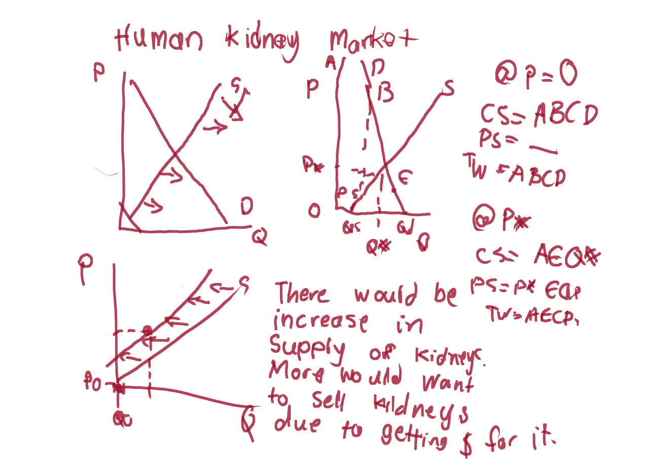 march17end-kidney